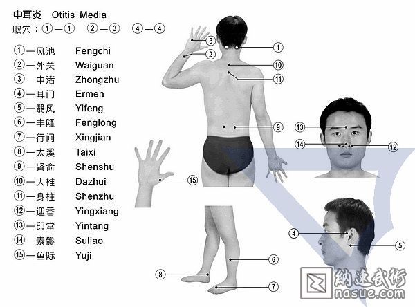 中耳炎的治疗图.jpg